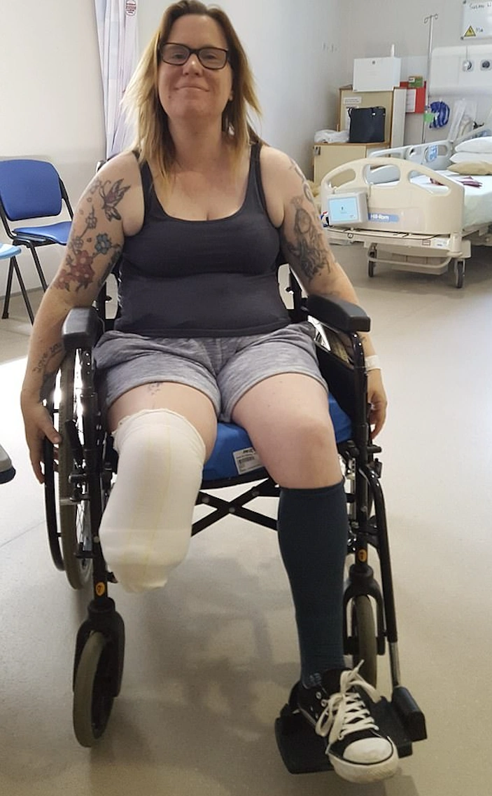 Joint discomfort limiting daily life